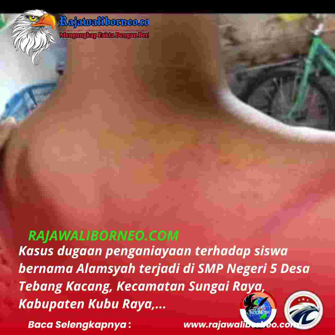 Pelajar SMP di Kubu Raya Diduga Dianiaya Oknum Guru, Orang Tua Minta Keadilan